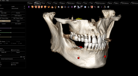 인비보(Invivo) 3D CT 장비